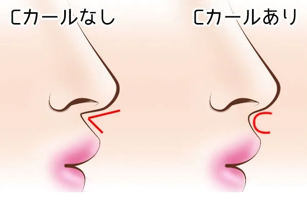 TAクリニックのCカール形成