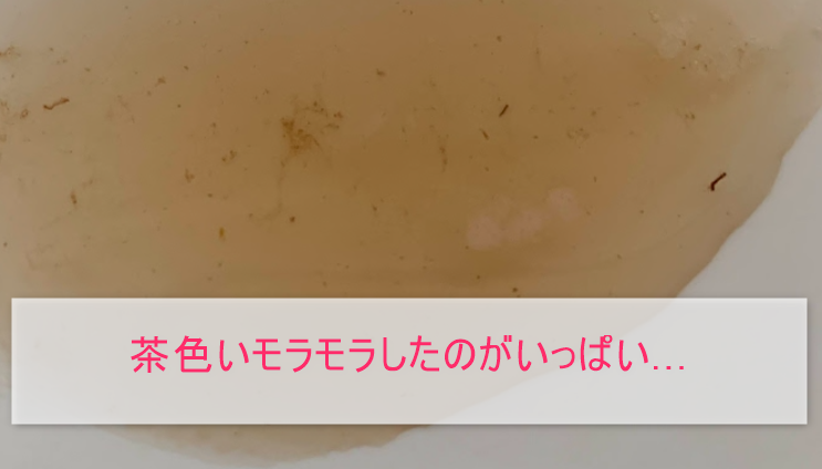 ブレスマイルウォッシュを使ってでた汚れの正体画像