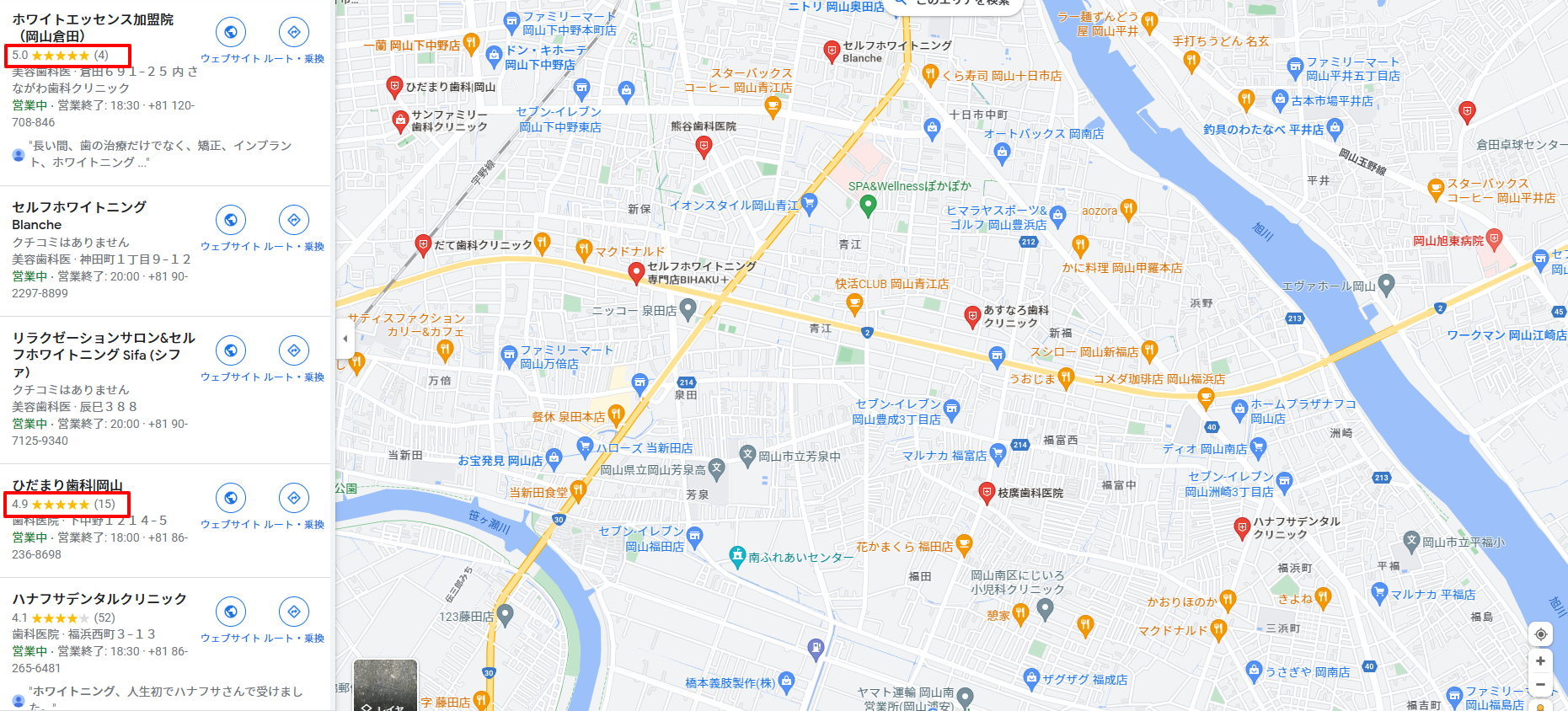 岡山のホワイトニングに関するGoogleの口コミ