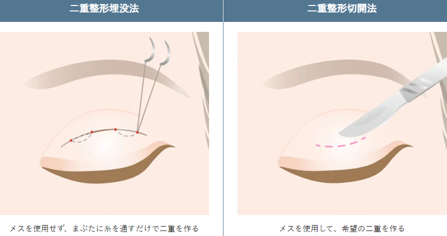 TCBの二重術