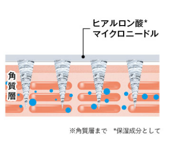 ヒアロディープパッチニードル