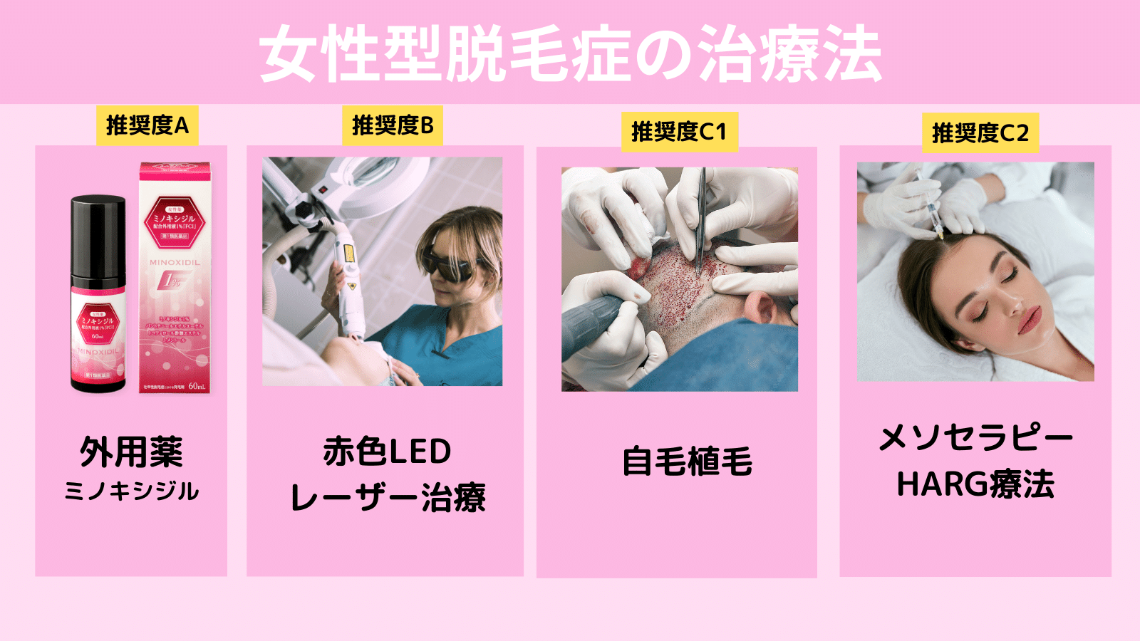 女性の薄毛治療法